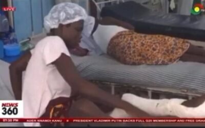 A possible amputation of girl, 15, was rescued by Verna Water intervention