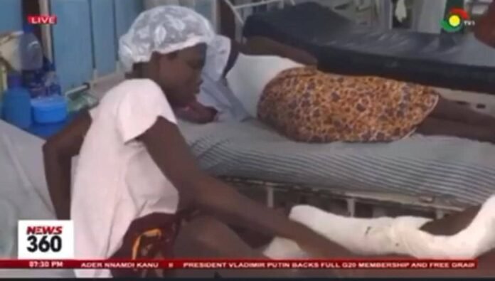 A possible amputation of girl, 15, was rescued by Verna Water intervention